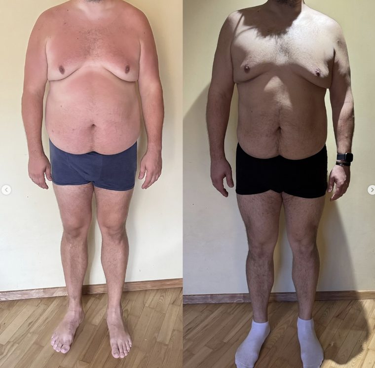 Žilvino transformacija — −16 kg